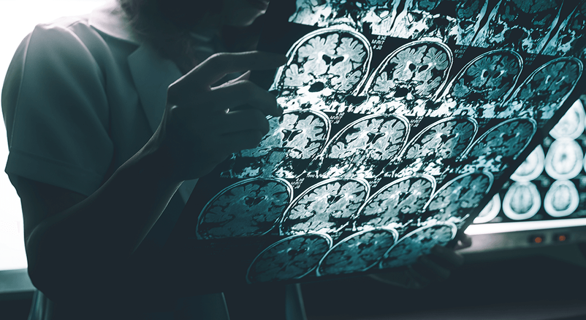 Using artificial intelligence to diagnose Alzheimer’s Disease