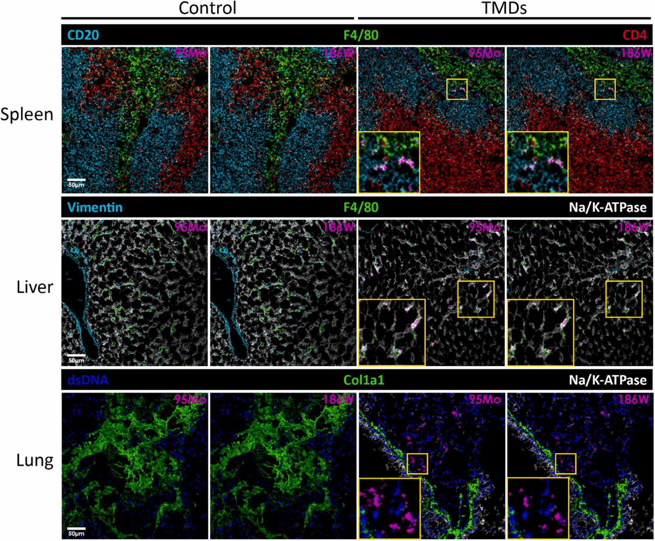A Leap Forward in Nanomedicine with Immune Profiling